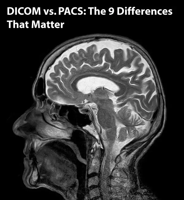 mri of head