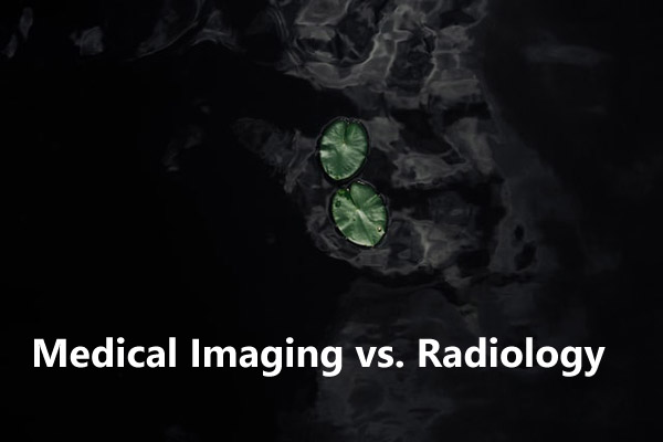 CT scan image