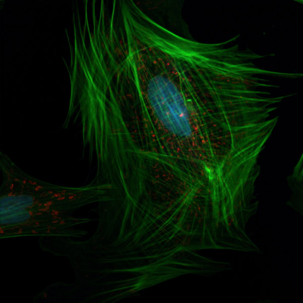 image from confocal microscope