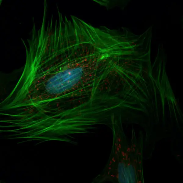 confocal microscope image