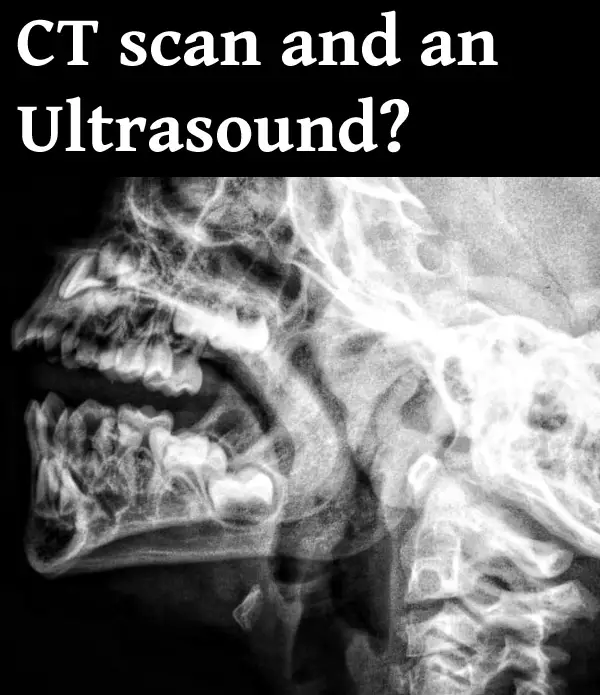 CT scan of head