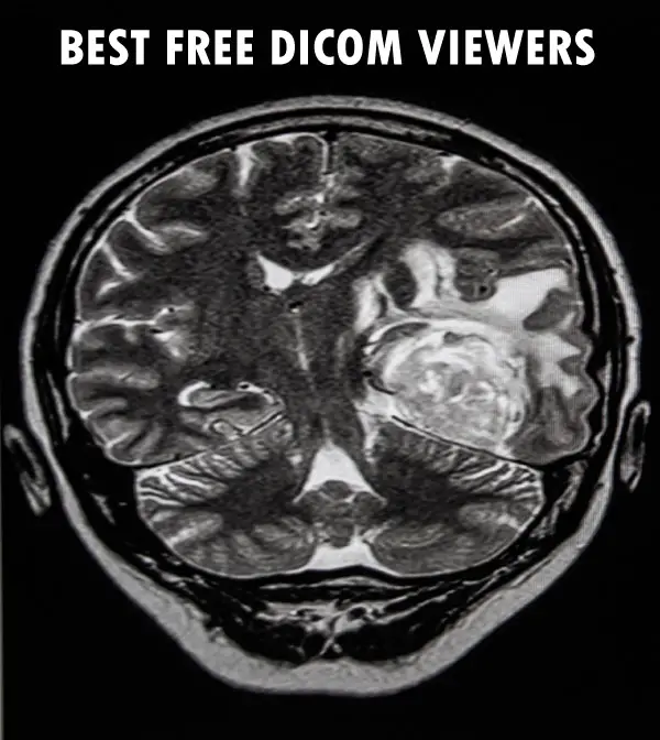 DICOM image in viewer