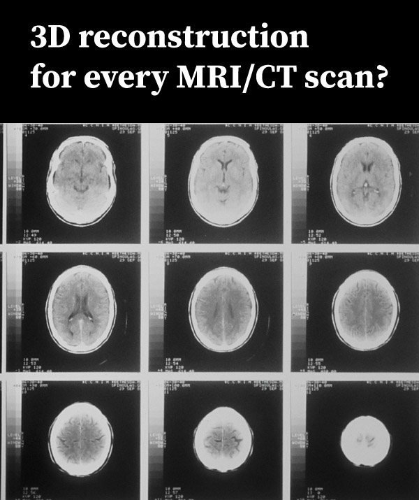 Series of MRI images